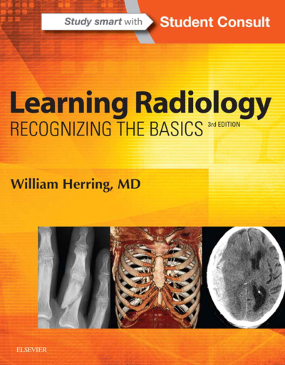 Learning Radiology: Recognizing The Basics / William Herring Panda Fotokopi & Baskı Merkezi